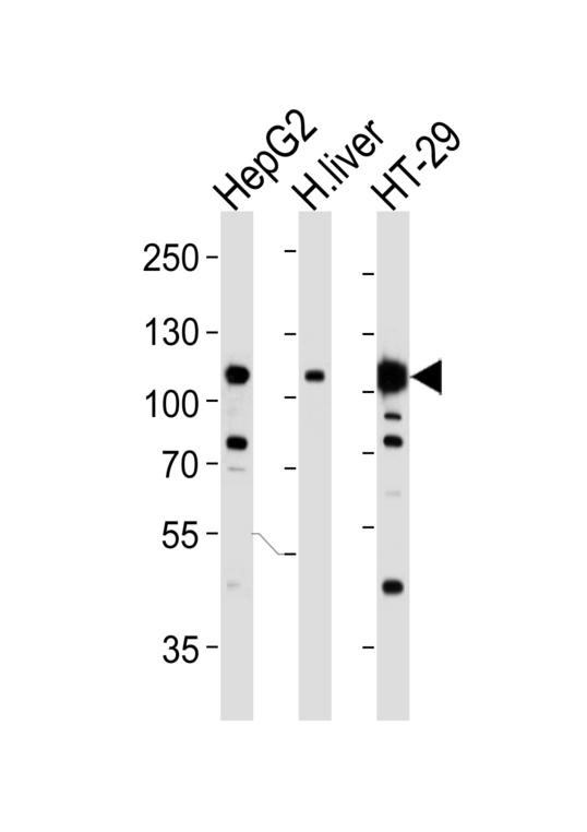 c-Met Antibody - Western blot of lysates from HepG2, H. liver, HT-29 cell line (from left to right), using MET/HGFR Antibody(4AT247. 86. 63). 4AT247. 86. 63 was diluted at 1:1000 at each lane. A goat anti-mouse IgG H&L (HRP) at 1:3000 dilution was used as the secondary antibody. Lysates at 35ug per lane.