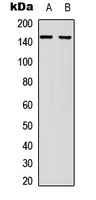 c-Met Antibody - Western blot analysis of c-Met expression in HeLa (A); A431 (B) whole cell lysates.