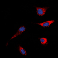 c-Met Antibody - Immunofluorescent analysis of c-Met staining in HeLa cells. Formalin-fixed cells were permeabilized with 0.1% Triton X-100 in TBS for 5-10 minutes and blocked with 3% BSA-PBS for 30 minutes at room temperature. Cells were probed with the primary antibody in 3% BSA-PBS and incubated overnight at 4 deg C in a humidified chamber. Cells were washed with PBST and incubated with a DyLight 594-conjugated secondary antibody (red) in PBS at room temperature in the dark. DAPI was used to stain the cell nuclei (blue).