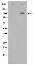 c-Met Antibody - Western blot of c-Met expression in HepG2 whole cell lysates,The lane on the left is treated with the antigen-specific peptide.