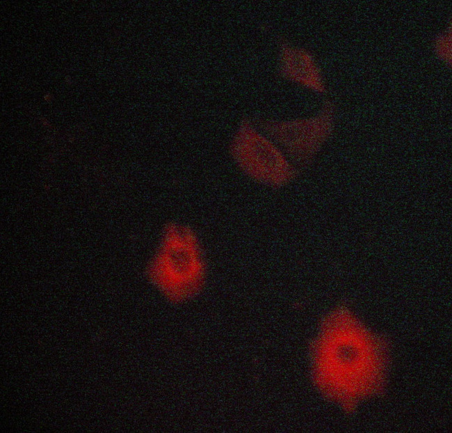 c-Met Antibody - Staining MCF-7 cells by IF/ICC. The samples were fixed with PFA and permeabilized in 0.1% saponin prior to blocking in 10% serum for 45 min at 37°C. The primary antibody was diluted 1/400 and incubated with the sample for 1 hour at 37°C. A Alexa Fluor® 594 conjugated goat polyclonal to rabbit IgG (H+L), diluted 1/600 was used as secondary antibody.