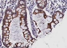 c-Met Antibody - 1:100 staining human colon tissue by IHC-P. The tissue was formaldehyde fixed and a heat mediated antigen retrieval step in citrate buffer was performed. The tissue was then blocked and incubated with the antibody for 1.5 hours at 22°C. An HRP conjugated goat anti-rabbit antibody was used as the secondary.