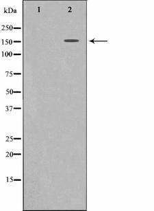 c-Met Antibody - Western blot analysis of c-Met expression in HepG2 whole cells lysates. The lane on the left is treated with the antigen-specific peptide.