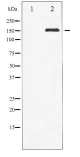 c-Met Antibody - Western blot of c-Met phosphorylation expression in HepG2 whole cell lysates,The lane on the left is treated with the antigen-specific peptide.