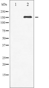 c-Met Antibody - Western blot analysis of c-Met phosphorylation expression in HepG2 whole cells lysates. The lane on the left is treated with the antigen-specific peptide.