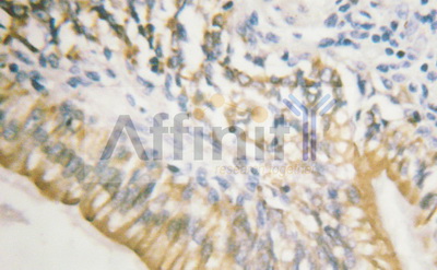 c-Met Antibody - Phospho-c-Met (Tyr1003) antibody for IHC in human testis