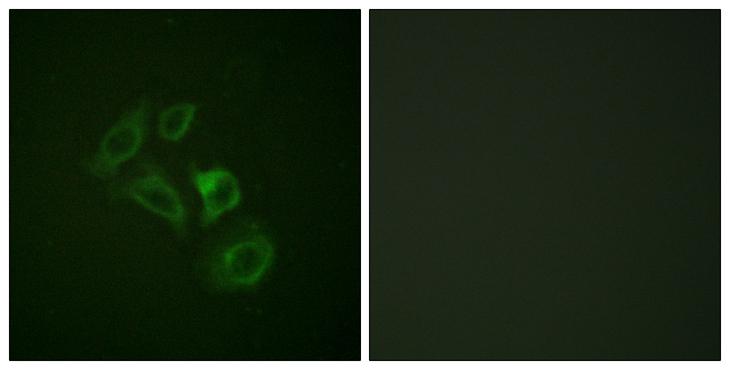 c-Met Antibody - P-peptide - + Immunofluorescence analysis of HepG2 cells, using c-Met (Phospho-Tyr1003) antibody.