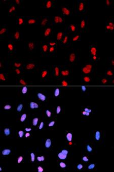 c-Met Antibody - Immunofluorescence analysis of U2OS cells.