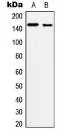 c-Met Antibody - Western blot analysis of c-Met (pY1234) expression in A431 (A); HepG2 (B) whole cell lysates.