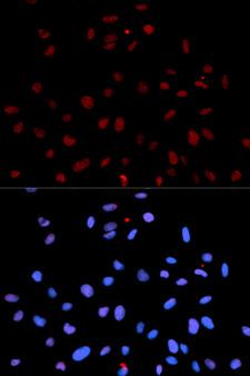 c-Met Antibody - Immunofluorescence analysis of U2OS cells.