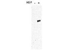 c-Met Antibody - Anti-c-Met pY1349pY1356 Antibody - Western Blot. Western blot of affinity purified anti-c-Met pY1349pY1356 antibody shows detection of phosphorylated c-Met. Human mammary B5/589 epithelial cells were serum-deprived and treated with or without HGF. Cell lysates were immunoprecipitated with the anti-c-Met antibody, resolved by SDS-PAGE, transferred to PVDF membrane, and probed with anti-c-Met pY1349pY1356. Personal communication, D. Bottaro and T. Ito, NCI, Bethesda, MD.