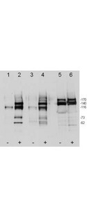 c-Met Antibody - Anti-c-Met pY1349pY1356 Antibody - Western Blot. Western blot of affinity purified anti-c-Met pY1349pY1356 antibody shows detection of phosphorylated c-Met. Human mammary epithelial cells (B5/589) were serum deprived and stimulated with (+) and without (-) HGF. Cell lysates were immunoprecipitated using a human anti-c-Met antibody, resolved by SDS-PAGE, transferred to PVDF membrane and probed using various antibodies. Lane 1 and 2 where probed using the anti-c-Met pY1349pY1356 antibody (#Anti-c-MET pY1349 pY1356 (RABBIT) Antibody), lane 3 and 4 where probed using an anti-phosphotyrosine antibody as phosphorylation control and lane 5 and 6 where probed using an anti-cMet antibody as a total Met loading control. Bands recognized at an apparent molecular weight of ~170 kD are total Met, ~145 kD phosphorylated Met beta chain in HGF +, ~150 kD phosphorylated Met in +/- HGF, ~50kD phosphorylated Met alpha chain. Personal communication with D. Bottaro and F. Cecchi, CCR-NCI, Bethesda, MD.
