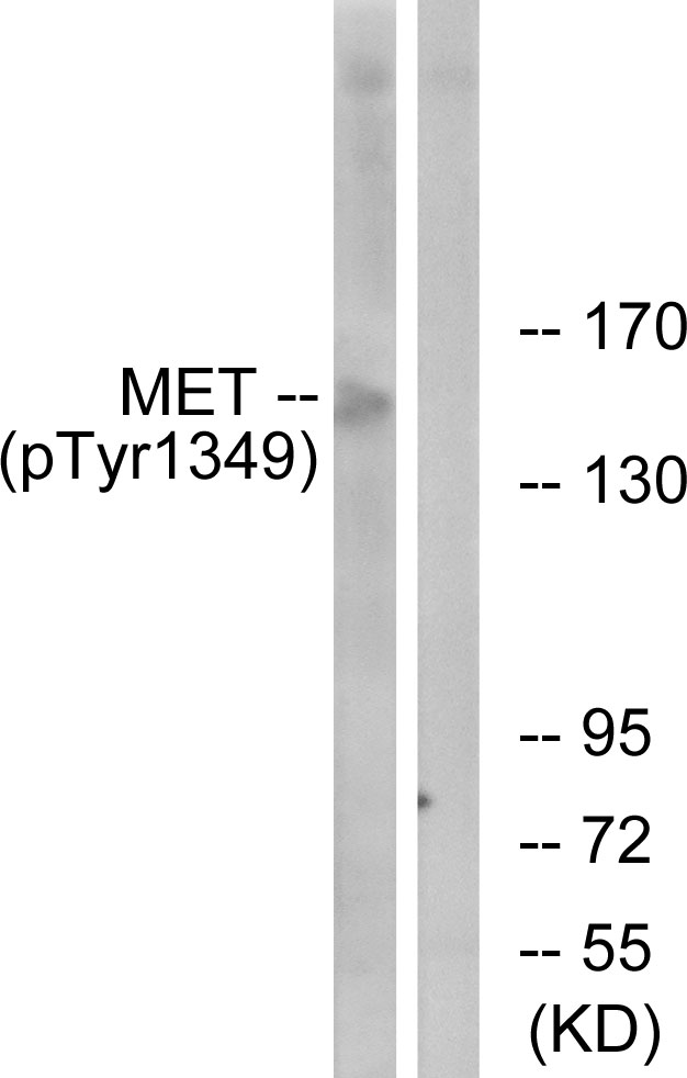 c-Met Antibody - Western blot analysis of lysates from HepG2 cells, using Met (Phospho-Tyr1349) Antibody. The lane on the right is blocked with the phospho peptide.