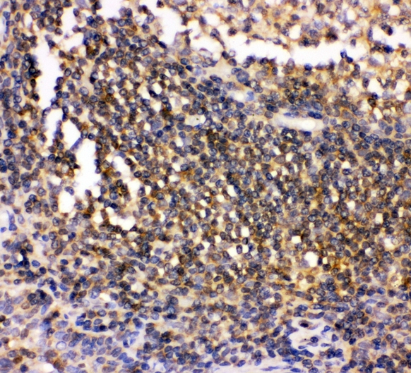 c-Src Kinase / CSK Antibody - IHC analysis of Csk using anti-Csk antibody. Csk was detected in paraffin-embedded section of human tonsil tissues. Heat mediated antigen retrieval was performed in citrate buffer (pH6, epitope retrieval solution) for 20 mins. The tissue section was blocked with 10% goat serum. The tissue section was then incubated with 1µg/ml rabbit anti-Csk Antibody overnight at 4°C. Biotinylated goat anti-rabbit IgG was used as secondary antibody and incubated for 30 minutes at 37°C. The tissue section was developed using Strepavidin-Biotin-Complex (SABC) with DAB as the chromogen.