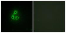c-Src Kinase / CSK Antibody - Immunofluorescence analysis of A549 cells, using CSK Antibody. The picture on the right is blocked with the synthesized peptide.