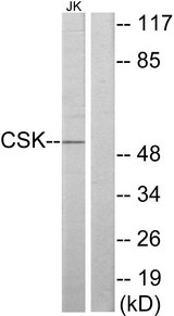 c-Src Kinase / CSK Antibody - Western blot analysis of lysates from Jurkat cells, using CSK Antibody. The lane on the right is blocked with the synthesized peptide.