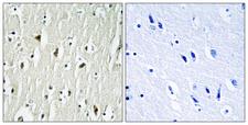 c-Src Kinase / CSK Antibody - Immunohistochemistry analysis of paraffin-embedded human brain tissue, using CSK Antibody. The picture on the right is blocked with the synthesized peptide.