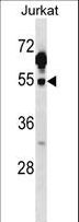 c-Src Kinase / CSK Antibody - Mouse Csk Antibody western blot of Jurkat cell line lysates (35 ug/lane). The Csk antibody detected the Csk protein (arrow).