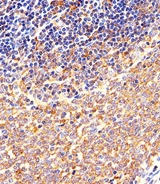 c-Src Kinase / CSK Antibody - Immunohistochemical of paraffin-embedded M.spleen section using Mouse Csk Antibody. Antibody was diluted at 1:25 dilution. A peroxidase-conjugated goat anti-rabbit IgG at 1:400 dilution was used as the secondary antibody, followed by DAB staining.
