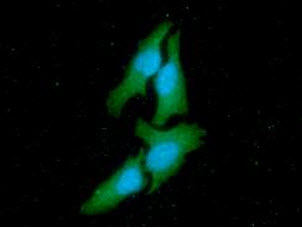 c-Src Kinase / CSK Antibody - ICC/IF analysis of CSK in HeLa cells line, stained with DAPI (Blue) for nucleus staining and monoclonal anti-human CSK antibody (1:100) with goat anti-mouse IgG-Alexa fluor 488 conjugate (Green).