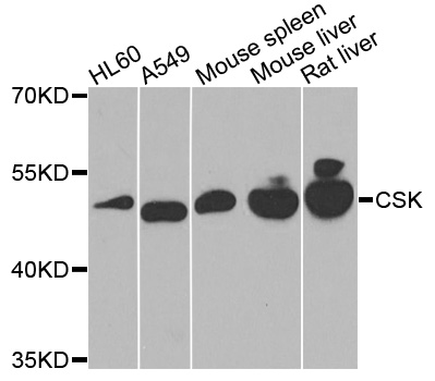 c-Src Kinase / CSK Antibody - Western blot analysis of extracts of various cell lines, using CSK antibody at 1:1000 dilution. The secondary antibody used was an HRP Goat Anti-Rabbit IgG (H+L) at 1:10000 dilution. Lysates were loaded 25ug per lane and 3% nonfat dry milk in TBST was used for blocking. An ECL Kit was used for detection and the exposure time was 90s.