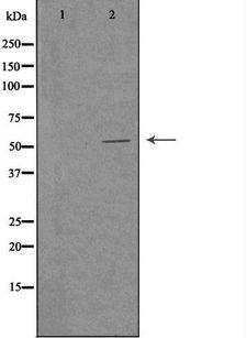 c-Src Kinase / CSK Antibody - Western blot analysis of extracts of Jurkat cells using CSK antibody. The lane on the left is treated with the antigen-specific peptide.