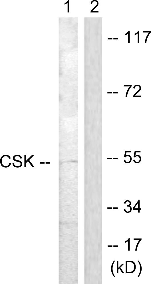 c-Src Kinase / CSK Antibody - Western blot analysis of extracts from RAW264.7cells, treated with UV (5mins), using Csk (Ab-364) antibody.