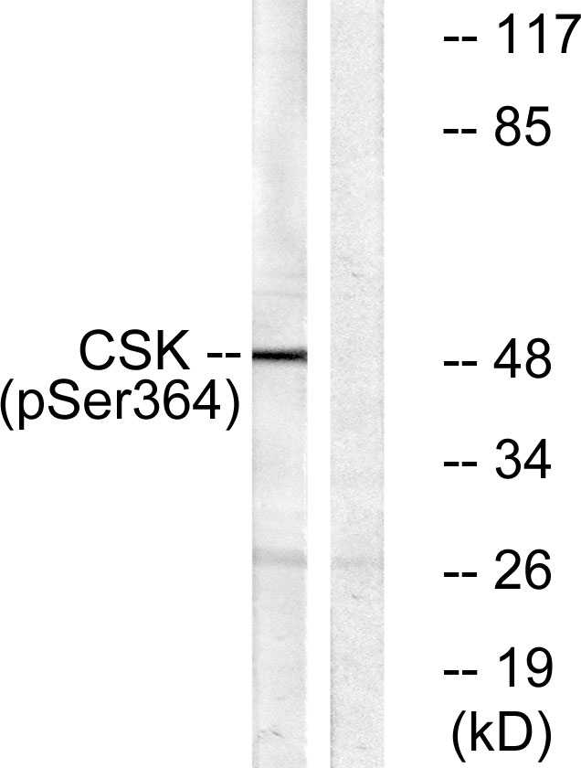 c-Src Kinase / CSK Antibody - Western blot analysis of lysates from HeLa cells treated with PMA 125ng/ml 30', using Csk (Phospho-Ser364) Antibody. The lane on the right is blocked with the phospho peptide.