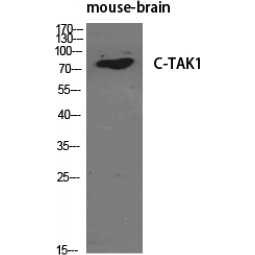 C-TAK1 / MARK3 Antibody - Western blot of C-TAK1 antibody