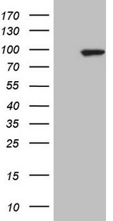 C-TAK1 / MARK3 Antibody - HEK293T cells were transfected with the pCMV6-ENTRY control. (Left lane) or pCMV6-ENTRY MARK3. (Right lane) cDNA for 48 hrs and lysed. Equivalent amounts of cell lysates. (5 ug per lane) were separated by SDS-PAGE and immunoblotted with anti-MARK3.