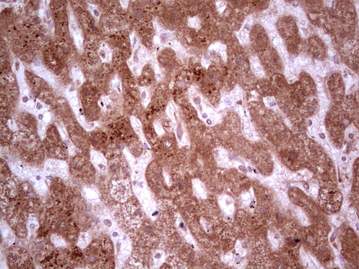 C-TAK1 / MARK3 Antibody - Immunohistochemical staining of paraffin-embedded Human liver tissue within the normal limits using anti-MARK3 mouse monoclonal antibody. (Heat-induced epitope retrieval by 1 mM EDTA in 10mM Tris, pH8.5, 120C for 3min,