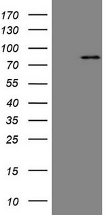 C-TAK1 / MARK3 Antibody - HEK293T cells were transfected with the pCMV6-ENTRY control. (Left lane) or pCMV6-ENTRY MARK3. (Right lane) cDNA for 48 hrs and lysed. Equivalent amounts of cell lysates. (5 ug per lane) were separated by SDS-PAGE and immunoblotted with anti-MARK3.