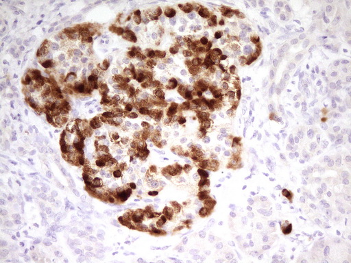 C-TAK1 / MARK3 Antibody - Immunohistochemical staining of paraffin-embedded Human pancreas tissue within the normal limits using anti-MARK3 mouse monoclonal antibody. (Heat-induced epitope retrieval by 1 mM EDTA in 10mM Tris, pH8.5, 120C for 3min,