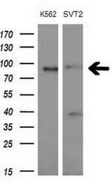 C-TAK1 / MARK3 Antibody - Western blot analysis of extracts. (10ug) from 2 different cell lines by using anti- MARK3monoclonal antibody at 1:200 dilution.
