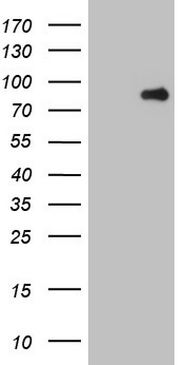 C-TAK1 / MARK3 Antibody - HEK293T cells were transfected with the pCMV6-ENTRY control (Left lane) or pCMV6-ENTRY MARK3 (Right lane) cDNA for 48 hrs and lysed. Equivalent amounts of cell lysates (5 ug per lane) were separated by SDS-PAGE and immunoblotted with anti-MARK3.