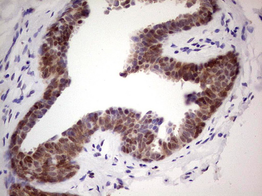 C-TAK1 / MARK3 Antibody - IHC of paraffin-embedded Human breast tissue using anti-MARK3 mouse monoclonal antibody. (Heat-induced epitope retrieval by 1 mM EDTA in 10mM Tris, pH8.5, 120°C for 3min).