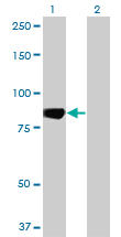 C-TAK1 / MARK3 Antibody - Western Blot analysis of MARK3 expression in transfected 293T cell line by MARK3 monoclonal antibody (M01), clone 1A10.Lane 1: MARK3 transfected lysate(81.4 KDa).Lane 2: Non-transfected lysate.