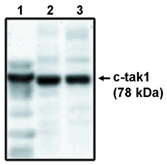 C-TAK1 / MARK3 Antibody - Western blot of c-tak1 antibody on His-tagged c-tak1 (1), RKO cell lysate (2) and HCT116 cell lysate (3).