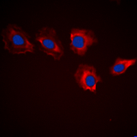 C-TAK1 / MARK3 Antibody - Immunofluorescent analysis of MARK3 staining in HeLa cells. Formalin-fixed cells were permeabilized with 0.1% Triton X-100 in TBS for 5-10 minutes and blocked with 3% BSA-PBS for 30 minutes at room temperature. Cells were probed with the primary antibody in 3% BSA-PBS and incubated overnight at 4 deg C in a humidified chamber. Cells were washed with PBST and incubated with a DyLight 594-conjugated secondary antibody (red) in PBS at room temperature in the dark. DAPI was used to stain the cell nuclei (blue).