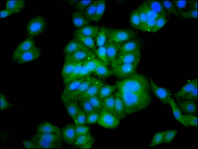 C10orf10 Antibody - Immunofluorescence staining of HepG2 cells diluted at 1:133, counter-stained with DAPI. The cells were fixed in 4% formaldehyde, permeabilized using 0.2% Triton X-100 and blocked in 10% normal Goat Serum. The cells were then incubated with the antibody overnight at 4°C.The Secondary antibody was Alexa Fluor 488-congugated AffiniPure Goat Anti-Rabbit IgG (H+L).