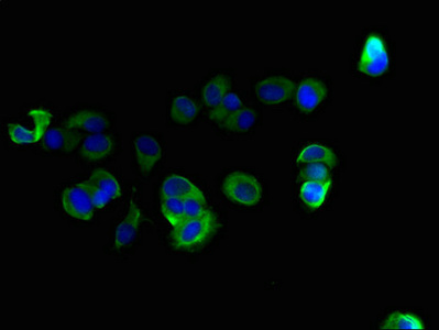 C10orf111 Antibody - Immunofluorescent analysis of MCF-7 cells using C10orf111 Antibody at dilution of 1:100 and Alexa Fluor 488-congugated AffiniPure Goat Anti-Rabbit IgG(H+L)