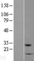 C10orf111 Protein - Western validation with an anti-DDK antibody * L: Control HEK293 lysate R: Over-expression lysate