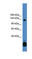 C10orf12 Antibody - C10orf12 antibody Western blot of Fetal Kidney lysate. This image was taken for the unconjugated form of this product. Other forms have not been tested.
