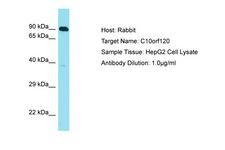 C10orf120 Antibody -  This image was taken for the unconjugated form of this product. Other forms have not been tested.