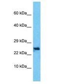 C10orf131 Antibody - C10orf131 antibody Western Blot of HepG2. Antibody dilution: 1 ug/ml.  This image was taken for the unconjugated form of this product. Other forms have not been tested.