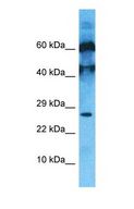 C10orf131 Antibody - Western blot of C10orf131 Antibody with human PANC1 Whole Cell lysate.  This image was taken for the unconjugated form of this product. Other forms have not been tested.