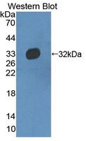 C10orf2 / PEO1 Antibody - Western blot of C10orf2 / PEO1 antibody.