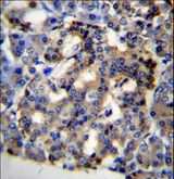 C10orf2 / PEO1 Antibody - C10orf2 Antibody immunohistochemistry of formalin-fixed and paraffin-embedded human pancreas tissue followed by peroxidase-conjugated secondary antibody and DAB staining.