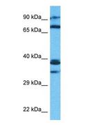 C10orf2 / PEO1 Antibody - Western blot of PEO1 Antibody with human MCF7 Whole Cell lysate.  This image was taken for the unconjugated form of this product. Other forms have not been tested.