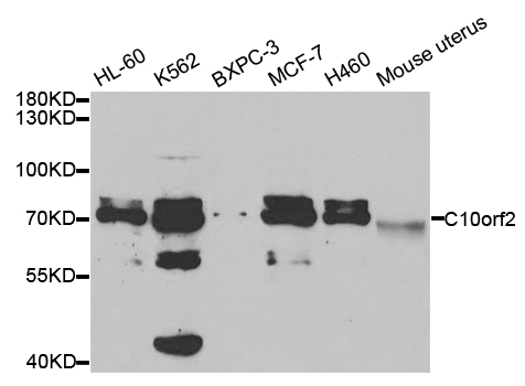 C10orf2 / PEO1 Antibody - Western blot analysis of extracts of various cell lines.